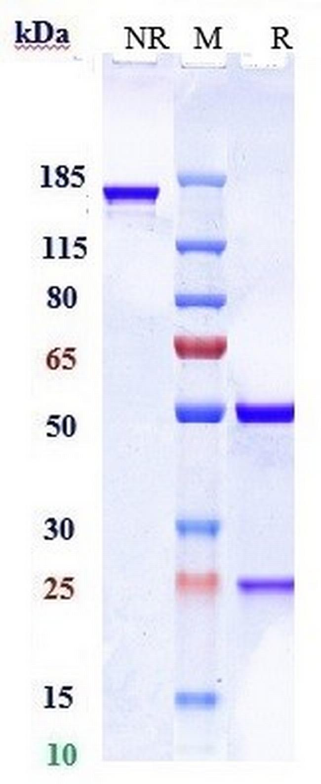 RHD (Roledumab Biosimilar) Antibody in SDS-PAGE (SDS-PAGE)