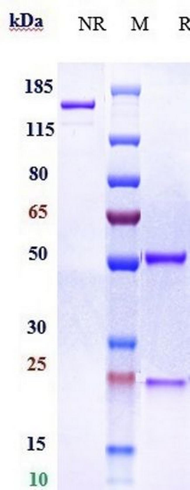 SIGLEC15 Humanized Biosimilar Antibody in SDS-PAGE (SDS-PAGE)