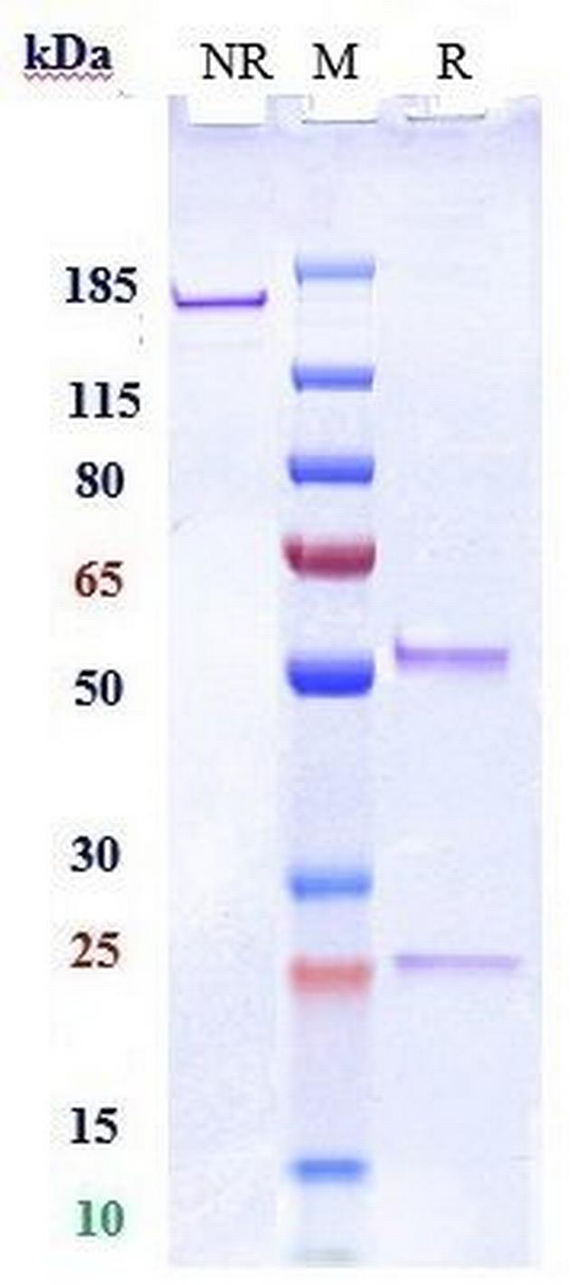 SIGLEC15 Biosimilar Antibody in SDS-PAGE (SDS-PAGE)