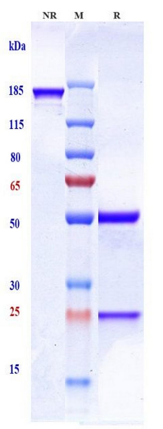 Sonepcizumab Humanized Antibody in SDS-PAGE (SDS-PAGE)