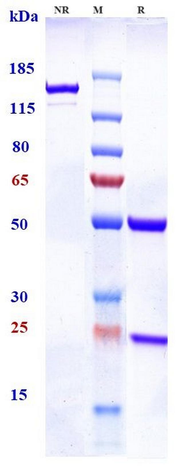 TGFBR2 Biosimilar Antibody in SDS-PAGE (SDS-PAGE)