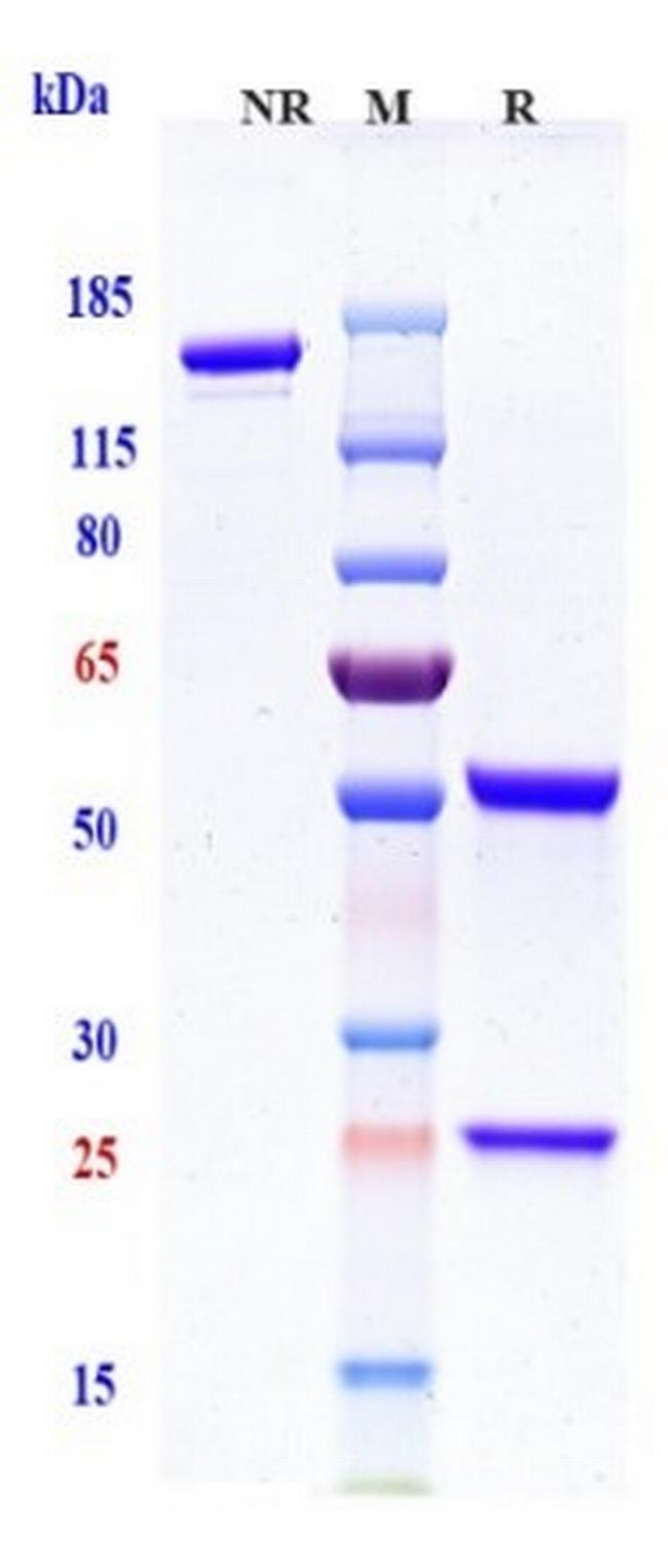 TIGIT (Etigilimab Biosimilar) Antibody in SDS-PAGE (SDS-PAGE)