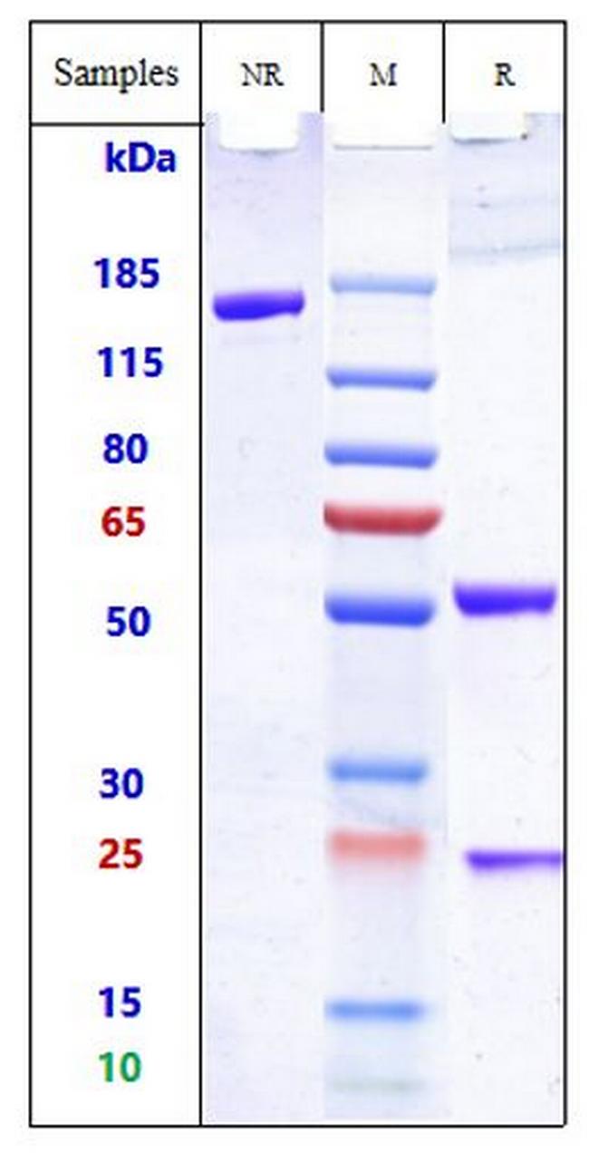 TCR Biosimilar Antibody in SDS-PAGE (SDS-PAGE)