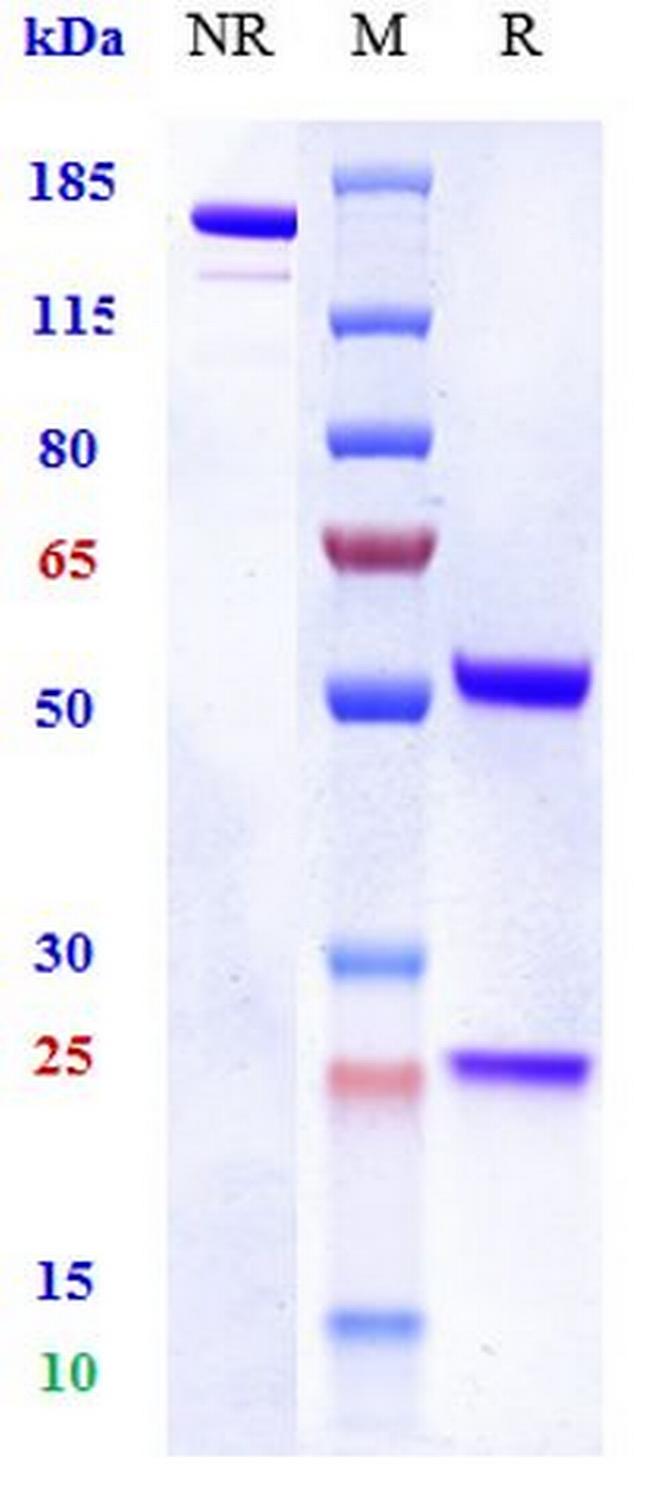 TNF beta (Pateclizumab Biosimilar) Antibody in SDS-PAGE (SDS-PAGE)