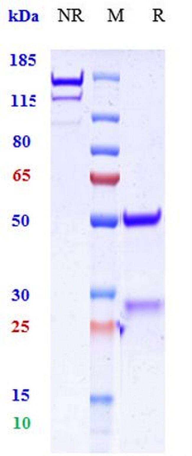 GAD65 Biosimilar Antibody in SDS-PAGE (SDS-PAGE)