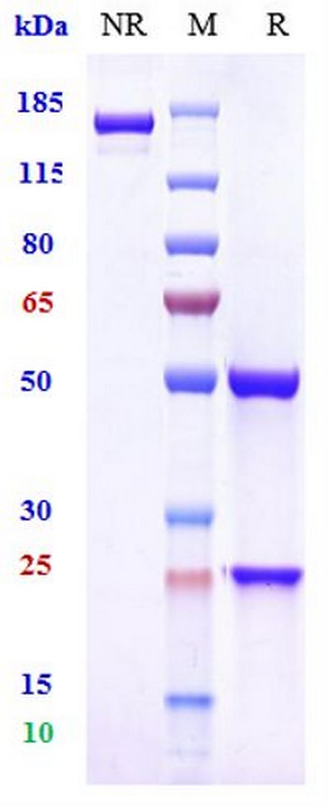 Sibeprenlimab Humanized Antibody in SDS-PAGE (SDS-PAGE)