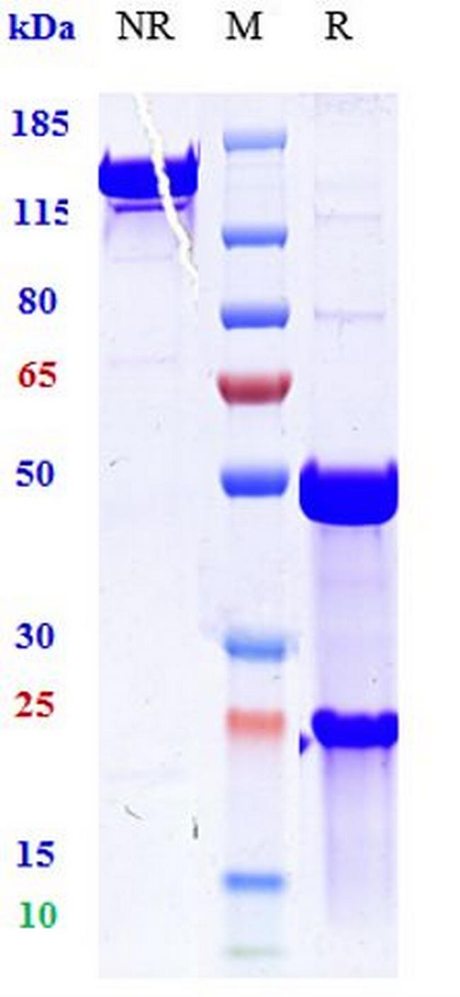 TNF alpha Biosimilar Antibody in SDS-PAGE (SDS-PAGE)