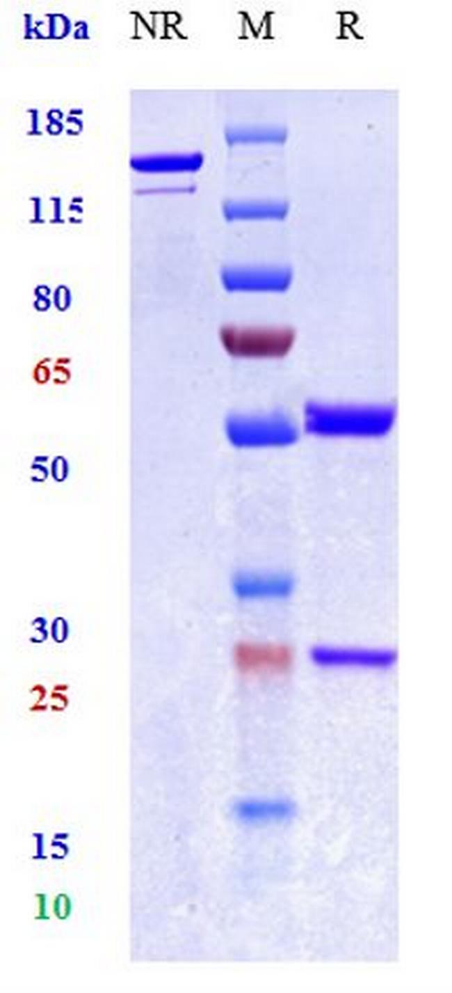 TNF alpha (Biosimilar) Antibody in SDS-PAGE (SDS-PAGE)