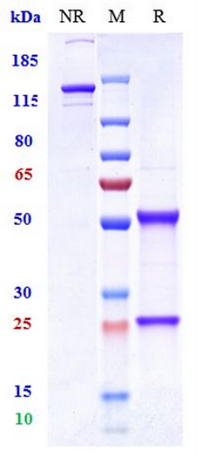 Vandortuzumab Humanized Antibody in SDS-PAGE (SDS-PAGE)