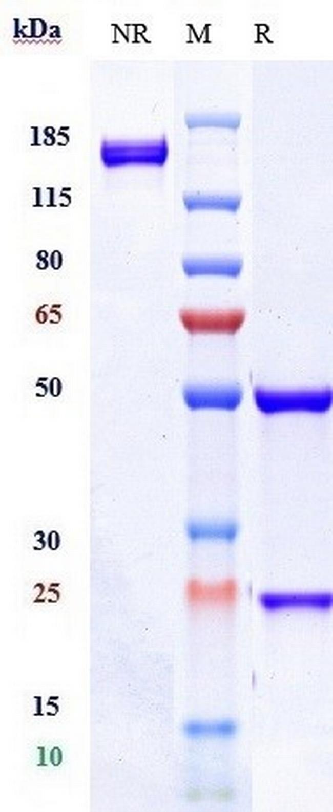 CD37 (Biosimilar) Antibody in SDS-PAGE (SDS-PAGE)