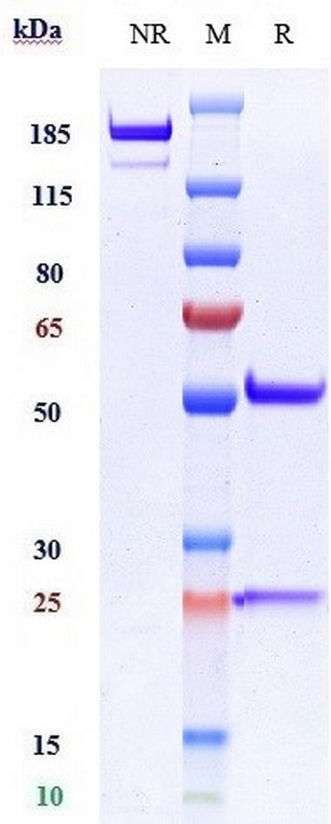 VCAM-1 (CD106) Biosimilar Antibody in SDS-PAGE (SDS-PAGE)