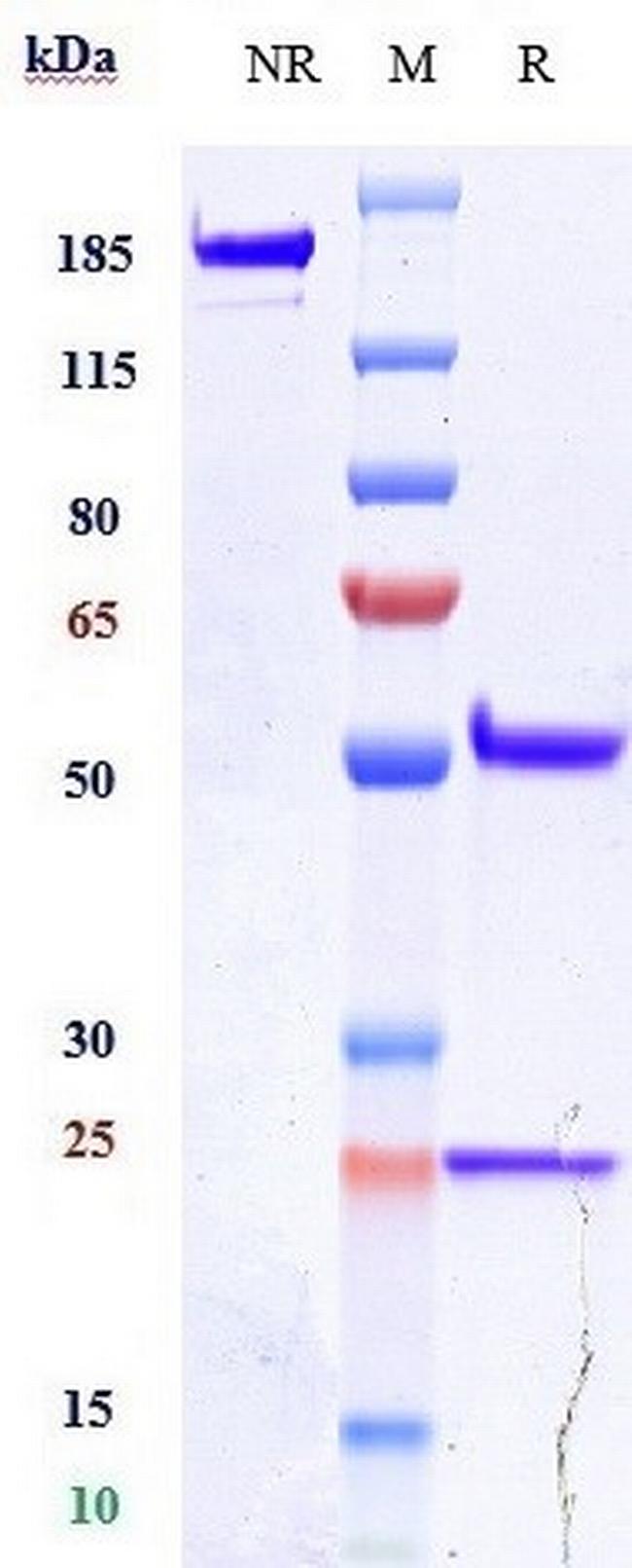 FLK1 (VEGF Receptor 2) (Alacizumab Biosimilar) Antibody in SDS-PAGE (SDS-PAGE)
