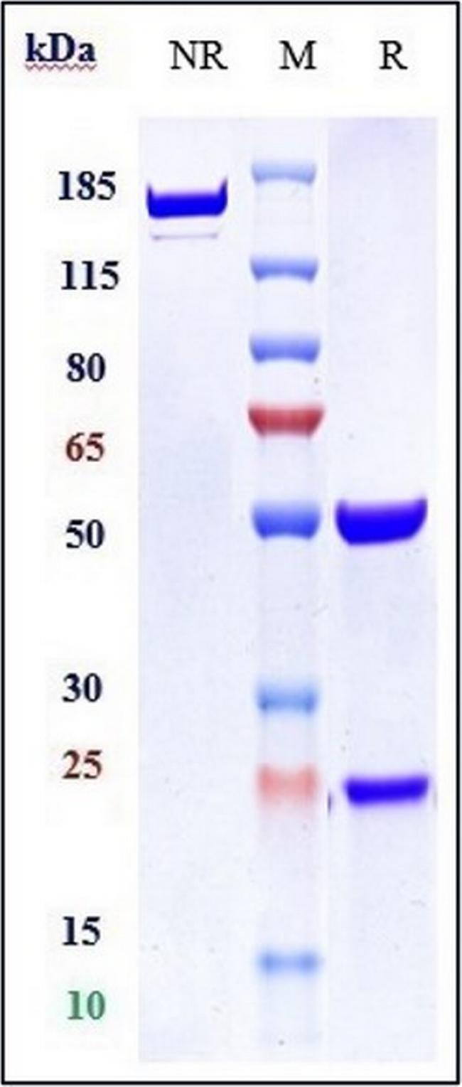 FLK1 (VEGF Receptor 2) (Biosimilar) Antibody in SDS-PAGE (SDS-PAGE)