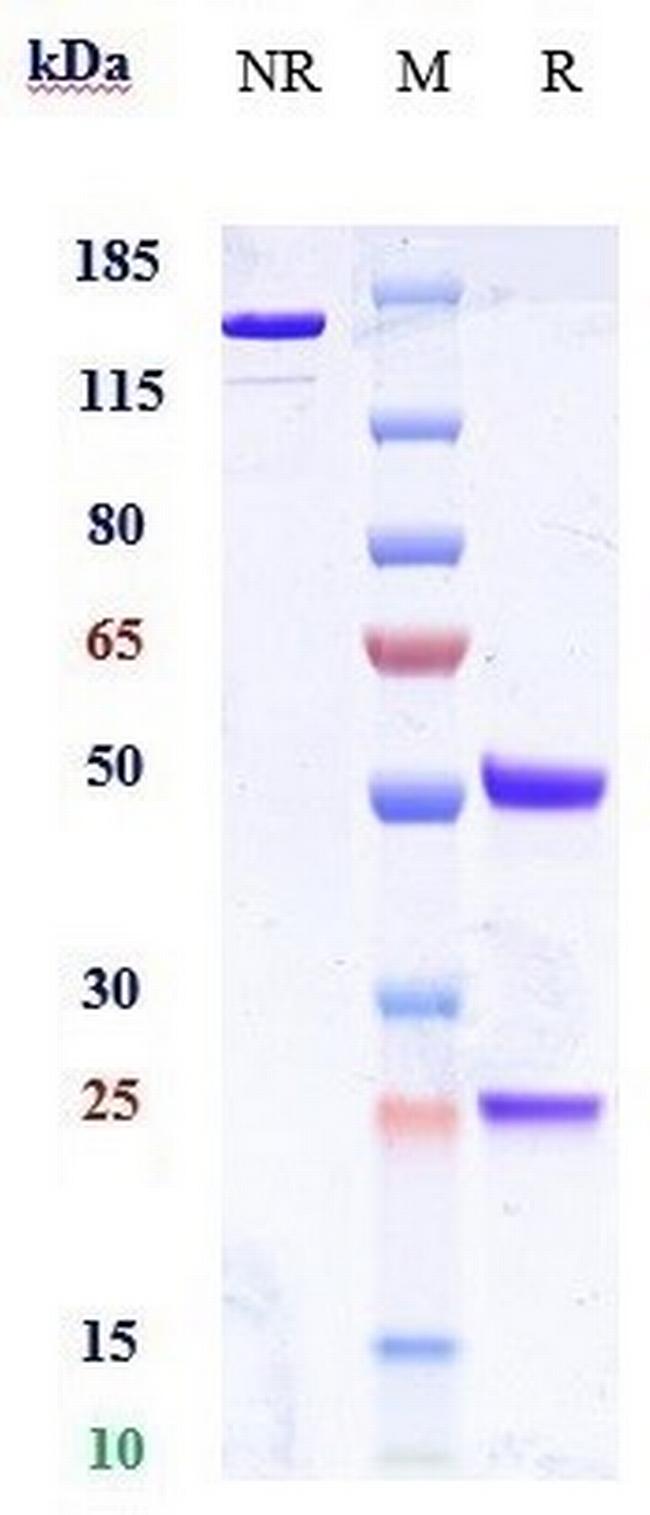 CD66e (CEACAM5) Biosimilar Antibody in SDS-PAGE (SDS-PAGE)