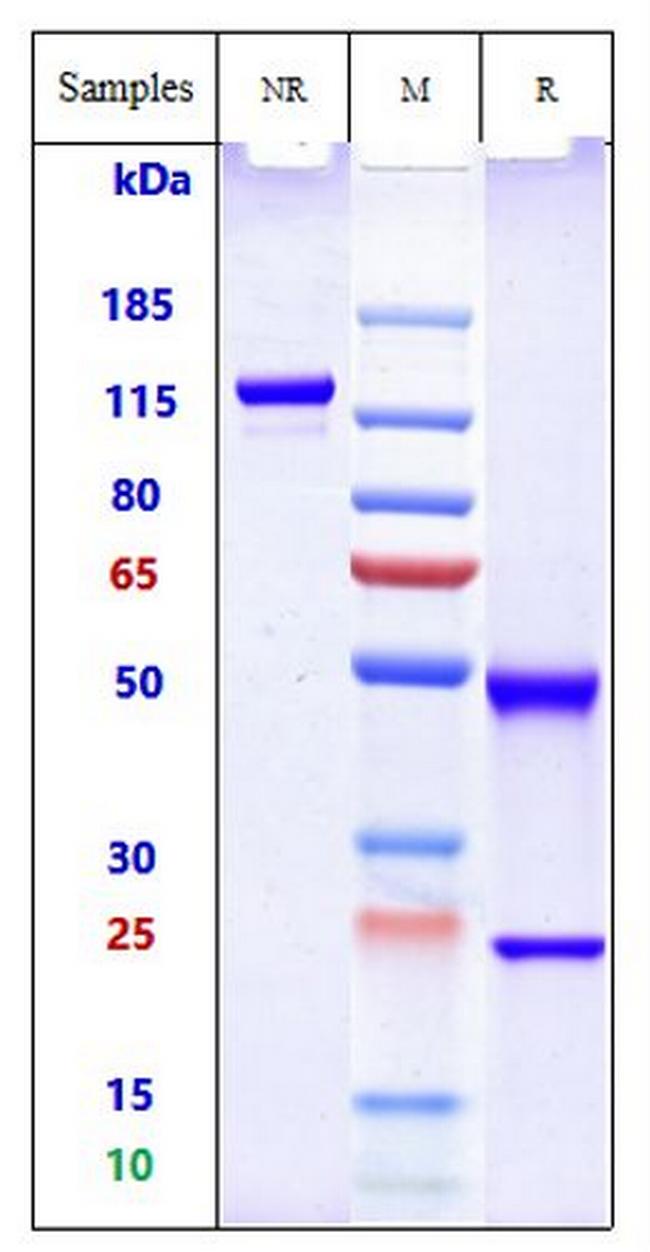 Placental Alkaline Phosphatase Biosimilar Antibody in SDS-PAGE (SDS-PAGE)