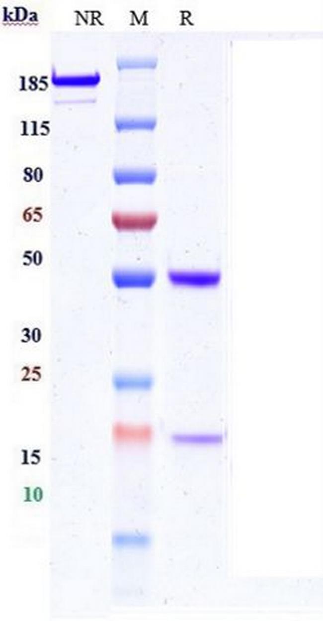 SEZ6 (Biosimilar) Antibody in SDS-PAGE (SDS-PAGE)