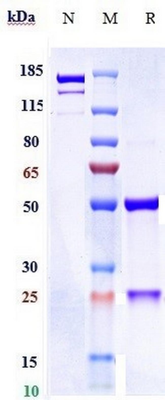 Hepatitis B Virus Surface Antigen (OST 577 Biosimilar) Antibody in SDS-PAGE (SDS-PAGE)