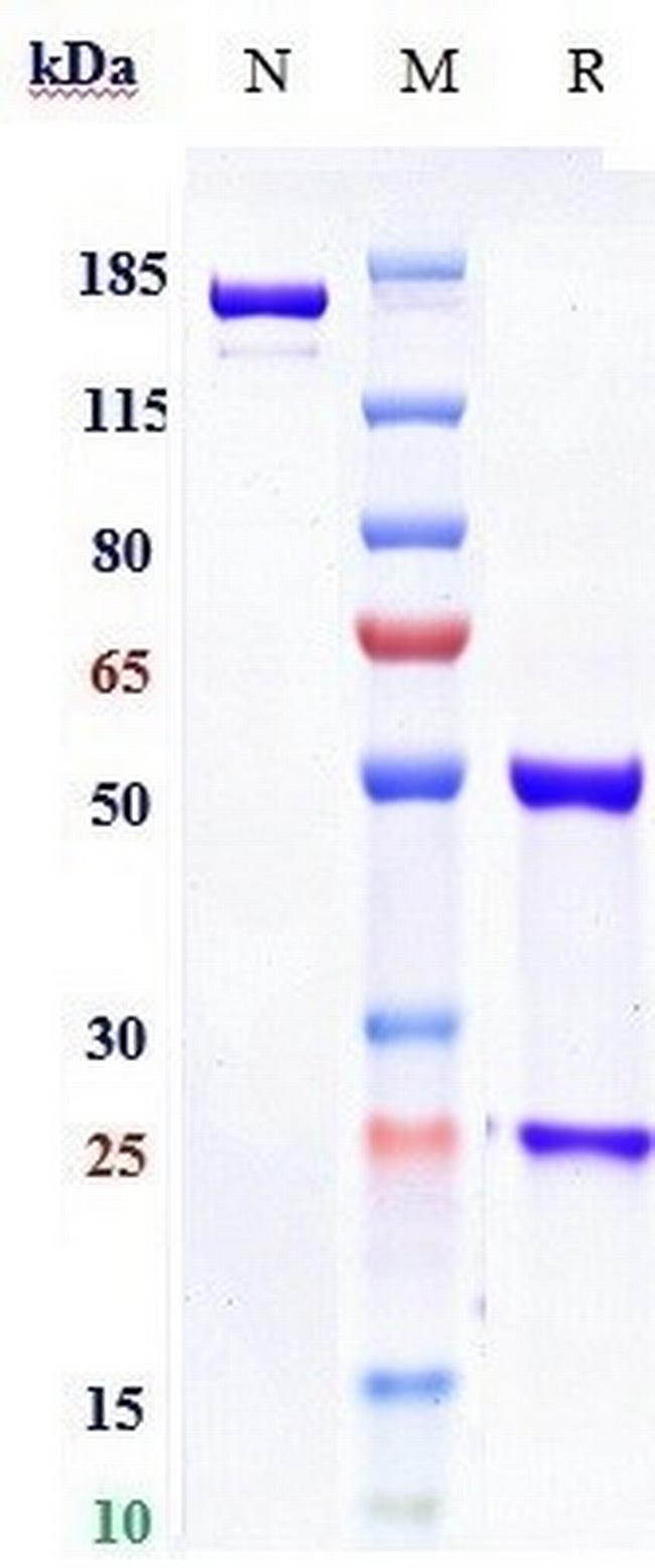 Foravirumab Antibody in SDS-PAGE (SDS-PAGE)