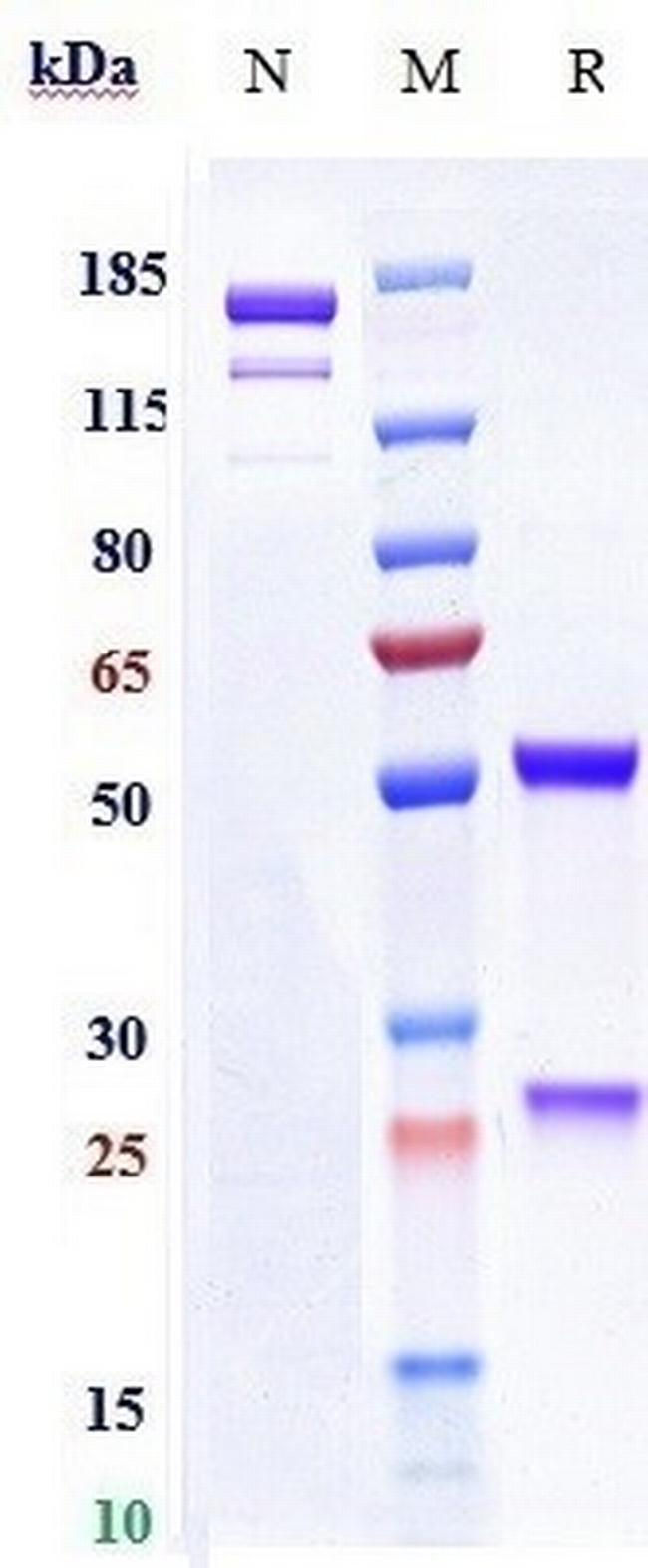 Rabies Virus Glycoprotein (Rafivirumab Biosimilar) Antibody in SDS-PAGE (SDS-PAGE)