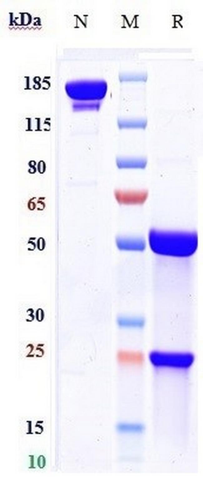 Palivizumab Humanized Antibody in SDS-PAGE (SDS-PAGE)