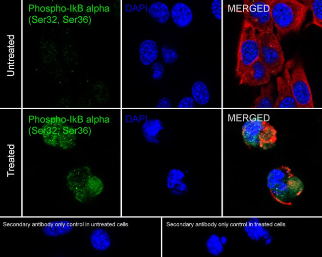 Phospho-IkB alpha (Ser32, Ser36) Antibody in Immunocytochemistry (ICC/IF)