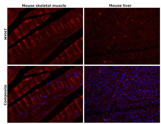 MYH7 Antibody in Immunohistochemistry (Paraffin) (IHC (P))