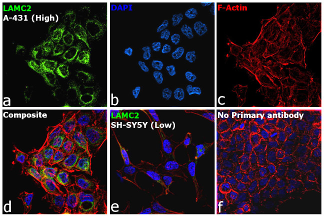 Laminin gamma-2 Antibody in Immunocytochemistry (ICC/IF)