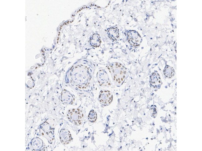 RAR gamma-1 Antibody in Immunohistochemistry (Paraffin) (IHC (P))