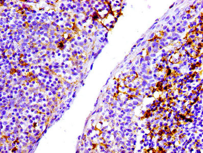 CD31 Antibody in Immunohistochemistry (Paraffin) (IHC (P))