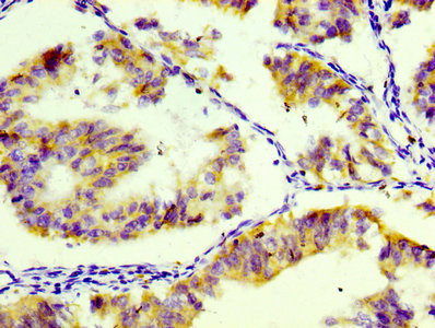 CD74 Antibody in Immunohistochemistry (Paraffin) (IHC (P))