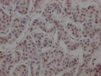 BRD4 Antibody in Immunohistochemistry (Paraffin) (IHC (P))