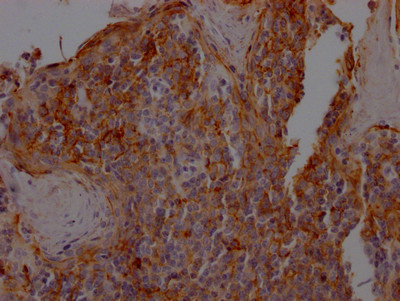 ICAM-1 Antibody in Immunohistochemistry (Paraffin) (IHC (P))