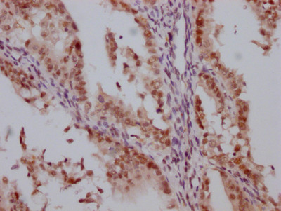 HDAC3 Antibody in Immunohistochemistry (Paraffin) (IHC (P))