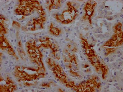 CD13 Antibody in Immunohistochemistry (Paraffin) (IHC (P))