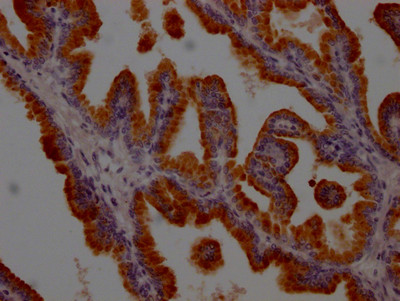 PSA Antibody in Immunohistochemistry (Paraffin) (IHC (P))