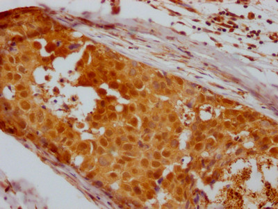 HDAC2 Antibody in Immunohistochemistry (Paraffin) (IHC (P))