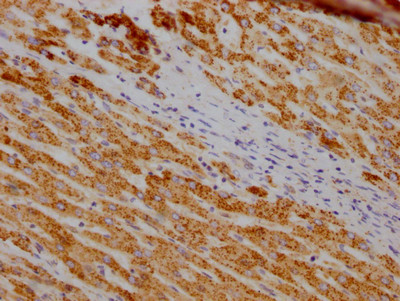 SOD2 Antibody in Immunohistochemistry (Paraffin) (IHC (P))