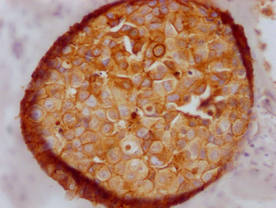 E-cadherin Antibody in Immunohistochemistry (Paraffin) (IHC (P))
