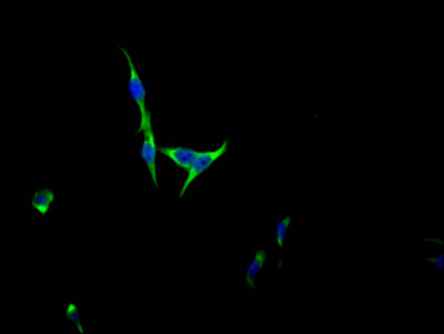 FGFR3 Antibody in Immunocytochemistry (ICC/IF)