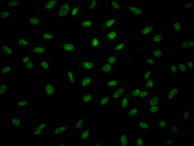 Granzyme B Antibody in Immunocytochemistry (ICC/IF)