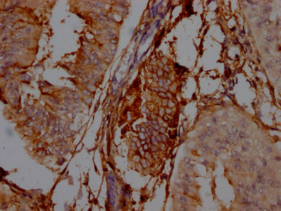 CD73 Antibody in Immunohistochemistry (Paraffin) (IHC (P))
