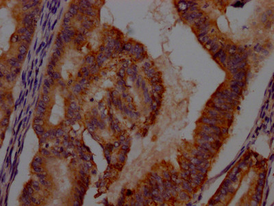 IDO Antibody in Immunohistochemistry (Paraffin) (IHC (P))