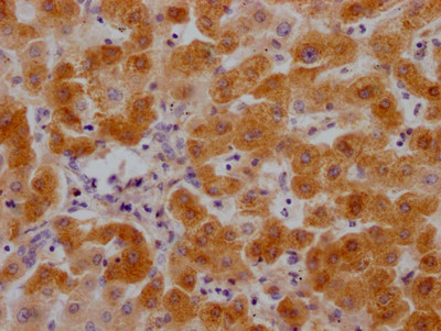 Complement C3 Antibody in Immunohistochemistry (Paraffin) (IHC (P))