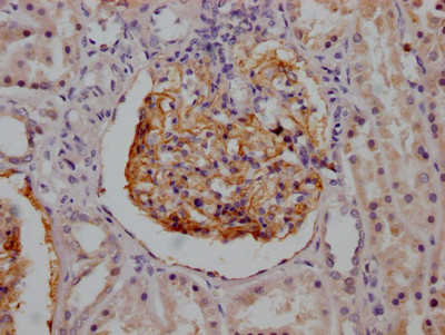 CD35 Antibody in Immunohistochemistry (Paraffin) (IHC (P))
