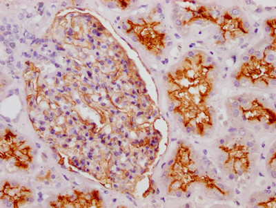 CD10 Antibody in Immunohistochemistry (Paraffin) (IHC (P))