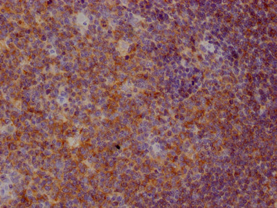 CD22 Antibody in Immunohistochemistry (Paraffin) (IHC (P))