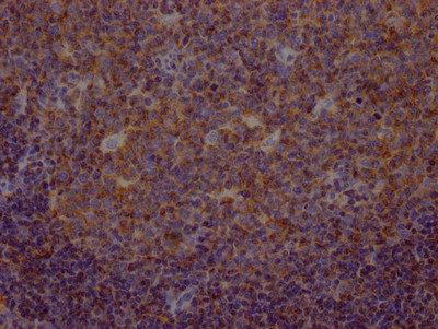 METAP2 Antibody in Immunohistochemistry (Paraffin) (IHC (P))