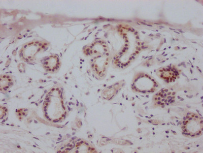 Estrogen Receptor alpha Antibody in Immunohistochemistry (Paraffin) (IHC (P))