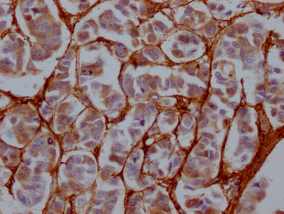 Fibronectin Antibody in Immunohistochemistry (Paraffin) (IHC (P))