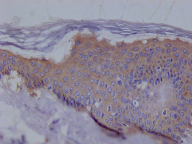 Ezrin Antibody in Immunohistochemistry (Paraffin) (IHC (P))